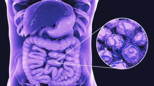 Intestines in Dreams